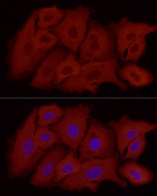 ALDH1A1 Antibody in Immunocytochemistry (ICC/IF)