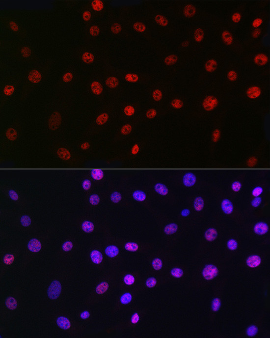 QKI Antibody in Immunocytochemistry (ICC/IF)