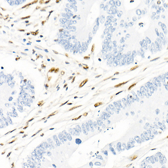 QKI Antibody in Immunohistochemistry (Paraffin) (IHC (P))