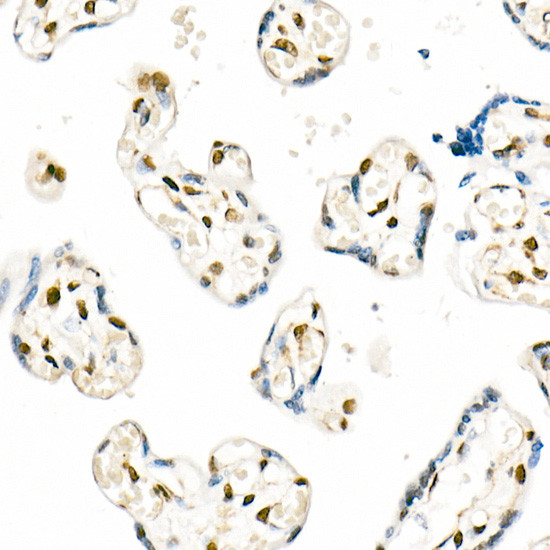 QKI Antibody in Immunohistochemistry (Paraffin) (IHC (P))