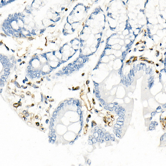 QKI Antibody in Immunohistochemistry (Paraffin) (IHC (P))