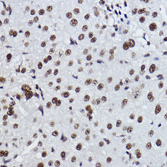 EXOSC7 Antibody in Immunohistochemistry (Paraffin) (IHC (P))