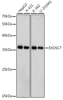 EXOSC7 Antibody in Western Blot (WB)