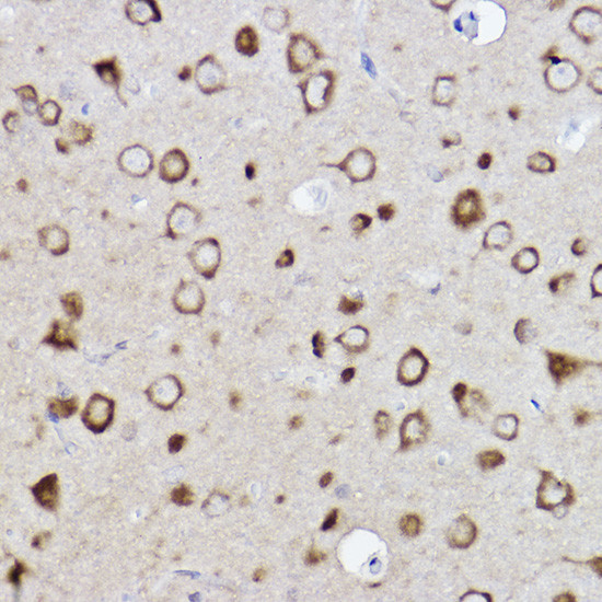 CARS Antibody in Immunohistochemistry (Paraffin) (IHC (P))