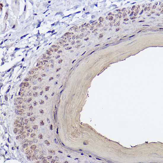 SERPINB3 Antibody in Immunohistochemistry (Paraffin) (IHC (P))