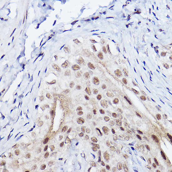 SERPINB3 Antibody in Immunohistochemistry (Paraffin) (IHC (P))