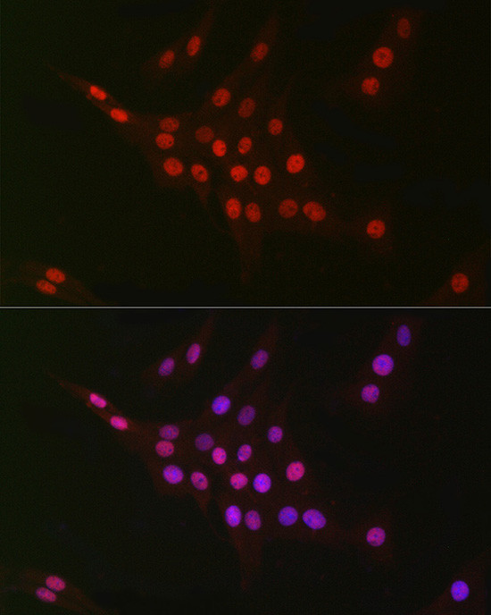 CtBP2 Antibody in Immunocytochemistry (ICC/IF)