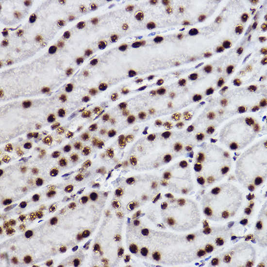 CtBP2 Antibody in Immunohistochemistry (Paraffin) (IHC (P))