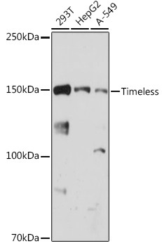 TIMELESS Antibody in Western Blot (WB)