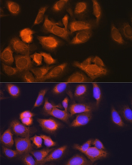 HK1 Antibody in Immunocytochemistry (ICC/IF)