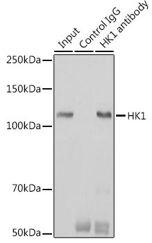 HK1 Antibody in Immunoprecipitation (IP)