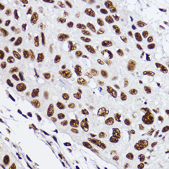 GTF2F2 Antibody in Immunohistochemistry (Paraffin) (IHC (P))