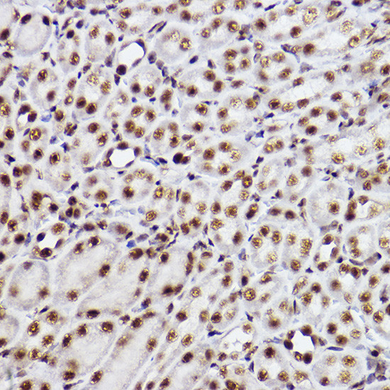 GTF2F2 Antibody in Immunohistochemistry (Paraffin) (IHC (P))