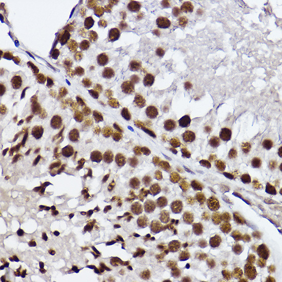 GTF2F2 Antibody in Immunohistochemistry (Paraffin) (IHC (P))