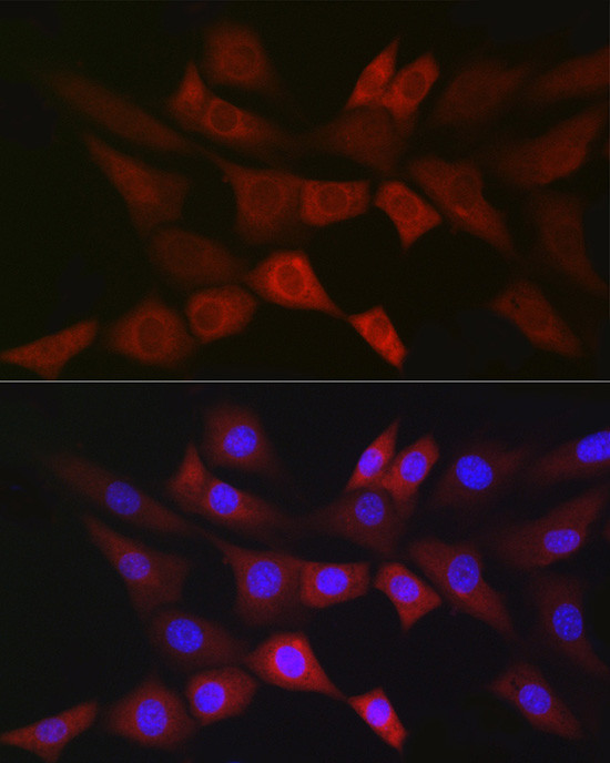 PGD Antibody in Immunocytochemistry (ICC/IF)