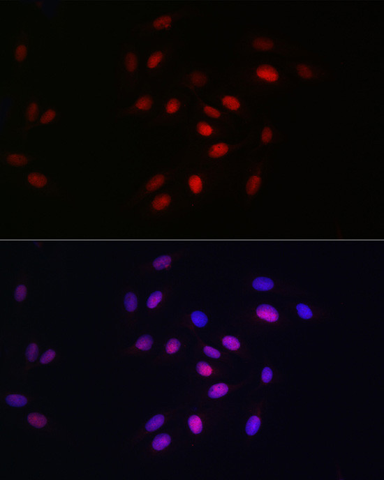 HDGF Antibody in Immunocytochemistry (ICC/IF)