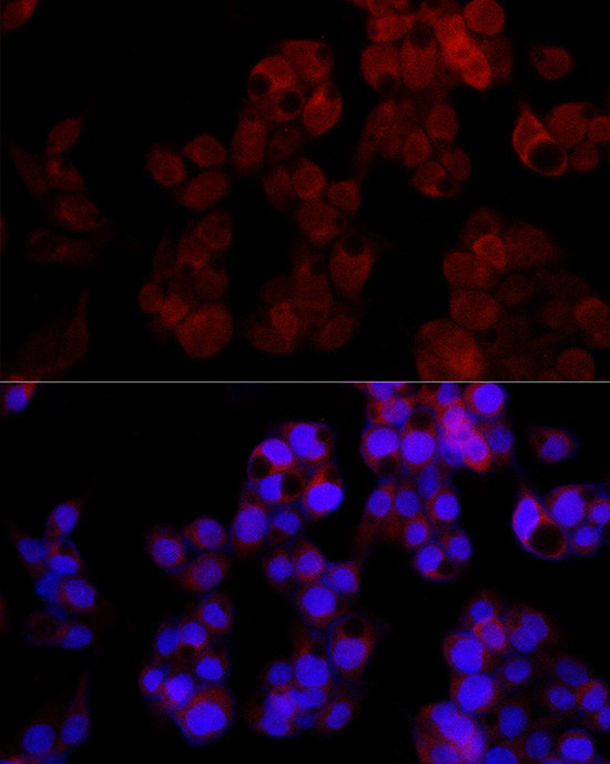 NUDT5 Antibody in Immunocytochemistry (ICC/IF)