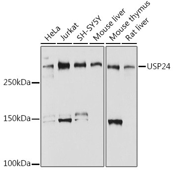 USP24 Antibody in Western Blot (WB)