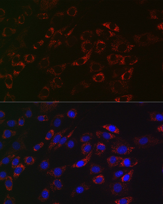 ACAA2 Antibody in Immunocytochemistry (ICC/IF)