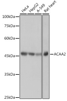 ACAA2 Antibody in Western Blot (WB)