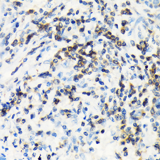 CSK Antibody in Immunohistochemistry (Paraffin) (IHC (P))