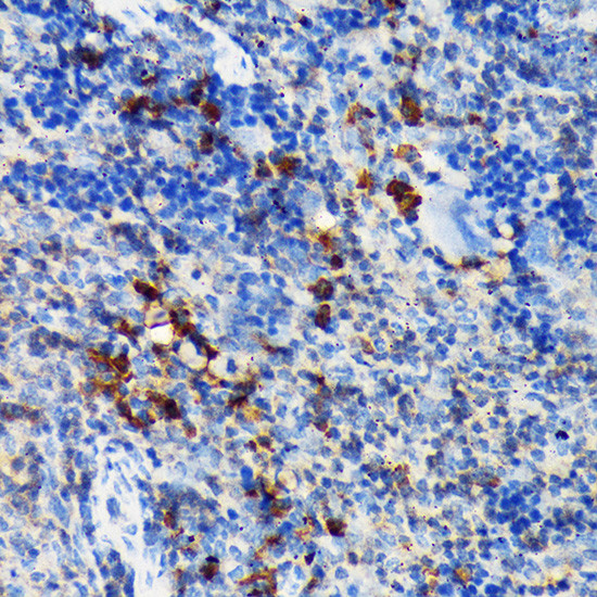 CSK Antibody in Immunohistochemistry (Paraffin) (IHC (P))