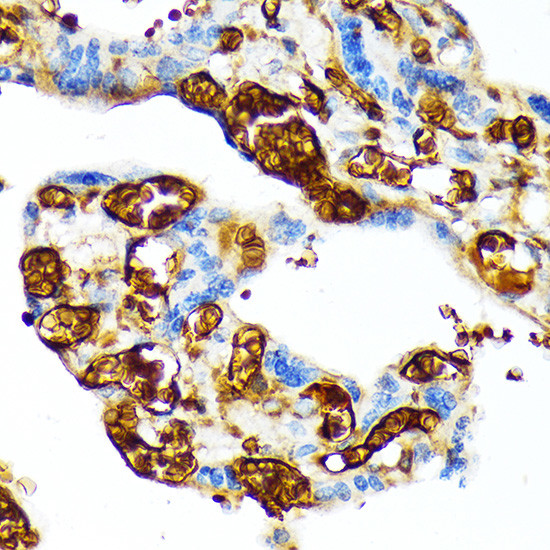 Hemoglobin gamma-1 Antibody in Immunohistochemistry (Paraffin) (IHC (P))