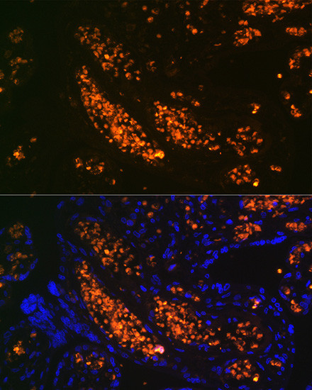 Hemoglobin gamma-1 Antibody in Immunohistochemistry (Paraffin) (IHC (P))