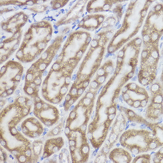 ERLIN2 Antibody in Immunohistochemistry (Paraffin) (IHC (P))