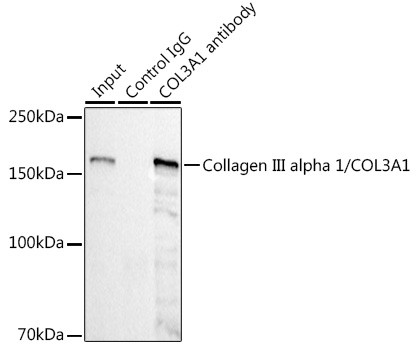 Collagen III Antibody in Immunoprecipitation (IP)
