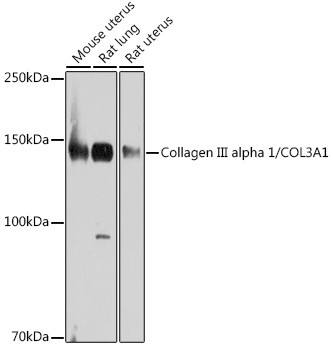 Collagen III Antibody in Western Blot (WB)