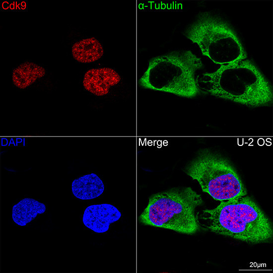 CDK9 Antibody in Immunocytochemistry (ICC/IF)