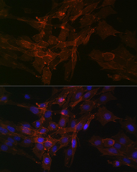 Sodium Potassium ATPase Antibody in Immunocytochemistry (ICC/IF)