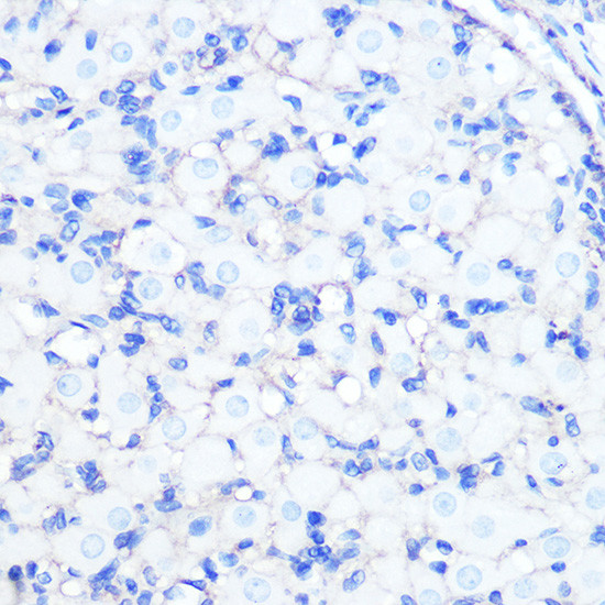 Sodium Potassium ATPase Antibody in Immunohistochemistry (Paraffin) (IHC (P))