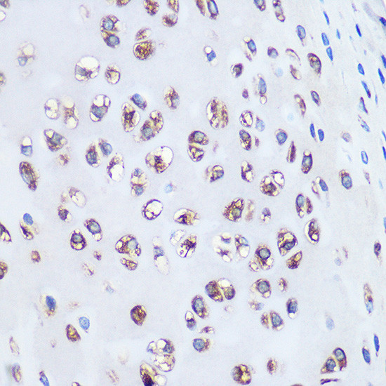 Aggrecan Antibody in Immunohistochemistry (Paraffin) (IHC (P))