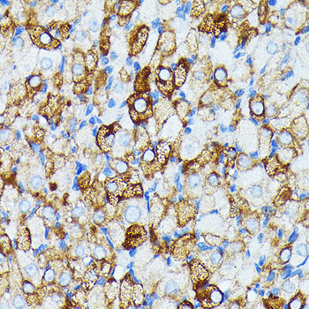 JAK1 Antibody in Immunohistochemistry (Paraffin) (IHC (P))