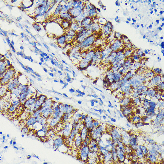 JAK1 Antibody in Immunohistochemistry (Paraffin) (IHC (P))