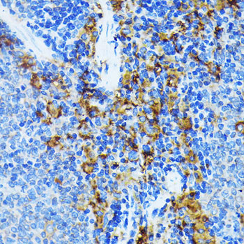 JAK1 Antibody in Immunohistochemistry (Paraffin) (IHC (P))