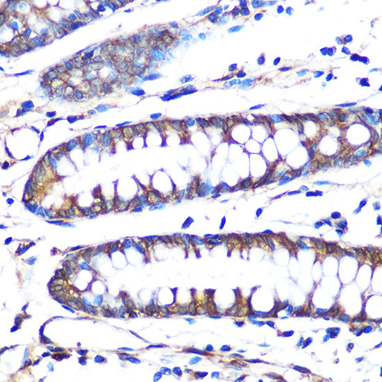 Aromatase Antibody in Immunohistochemistry (Paraffin) (IHC (P))