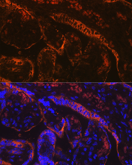 Aromatase Antibody in Immunohistochemistry (Paraffin) (IHC (P))