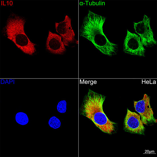 IL-10 Antibody in Immunocytochemistry (ICC/IF)