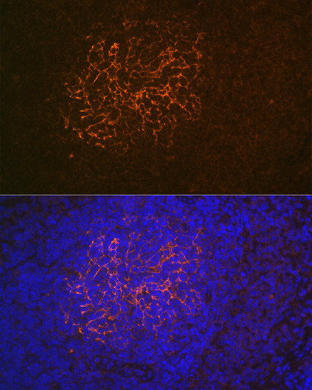 CD21 Antibody in Immunohistochemistry (Paraffin) (IHC (P))