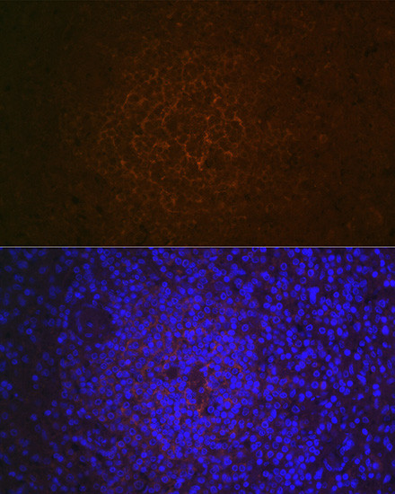 CD21 Antibody in Immunohistochemistry (Paraffin) (IHC (P))