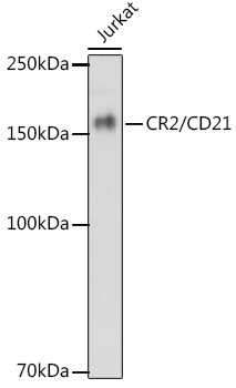 CD21 Antibody in Western Blot (WB)