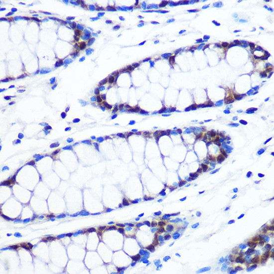 BRD4 Antibody in Immunohistochemistry (Paraffin) (IHC (P))