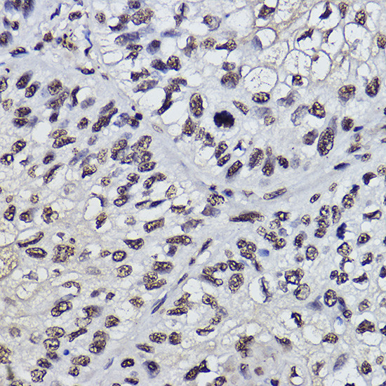 PDCD7 Antibody in Immunohistochemistry (Paraffin) (IHC (P))
