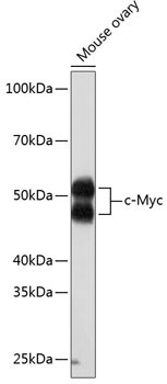 c-Myc Antibody in Western Blot (WB)