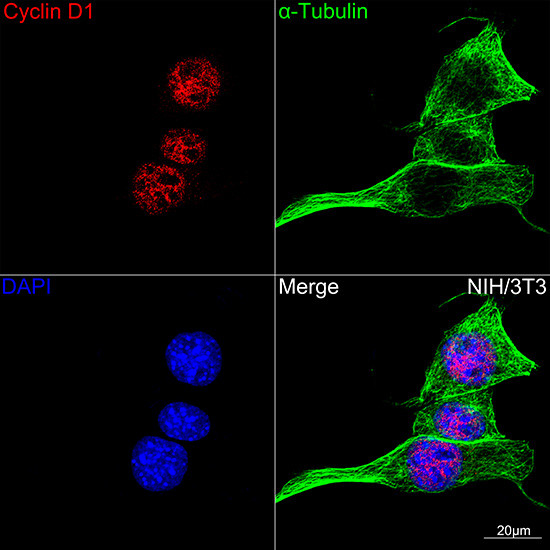 Cyclin D1 Antibody in Immunocytochemistry (ICC/IF)