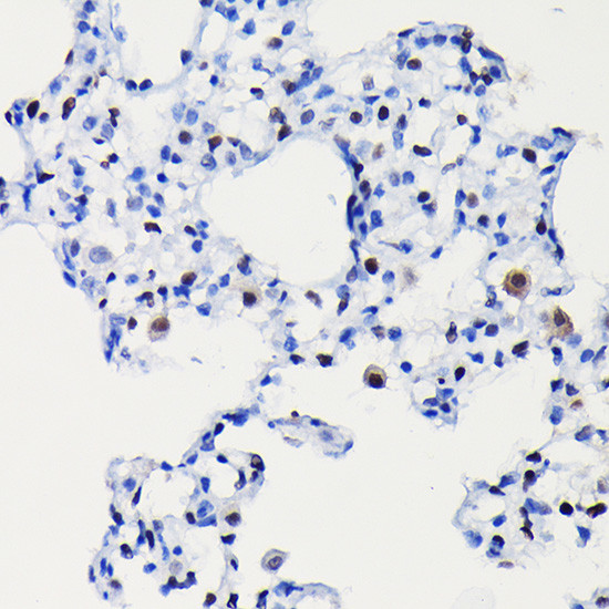 Cyclin D1 Antibody in Immunohistochemistry (Paraffin) (IHC (P))