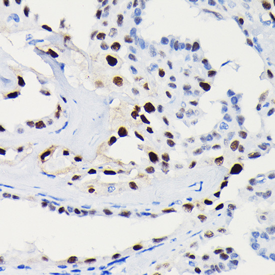 Cyclin D1 Antibody in Immunohistochemistry (Paraffin) (IHC (P))